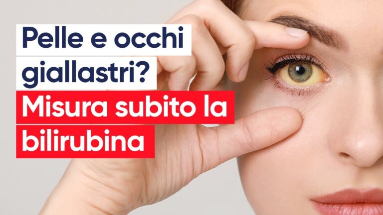 Bilirubina Alta: Il Collegamento con lo Stress