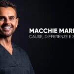 Quanto Costa Mettere 3 Denti: Guida Completa