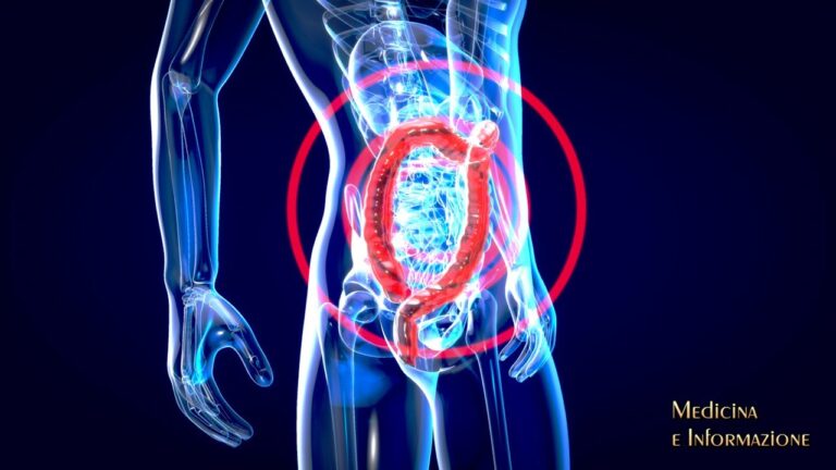 Patologie dell’intestino tenue: guida completa