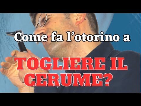 Costo della Pulizia delle Orecchie dal Otorino