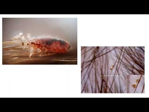 Guida completa alla scabbia pubica: cause, sintomi e trattamenti