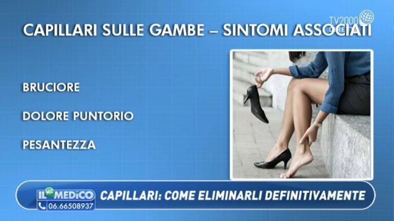 Esperto in Vene e Capillari: Salute e Benessere Circolatorio