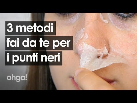 Addio punti neri in 3 minuti: Il metodo efficace