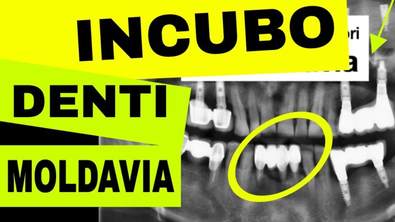Il miglior dentista economico vicino a te
