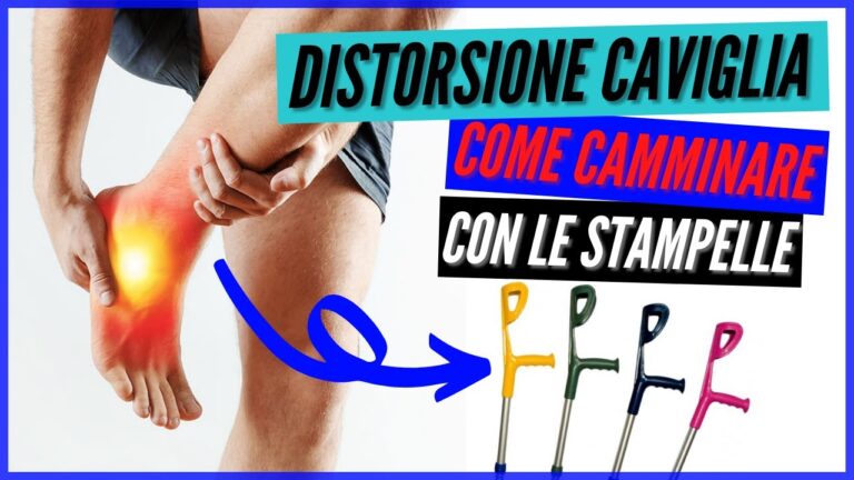 Tempo di recupero dalla distorsione alla caviglia: Quando riprendere a camminare
