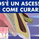 Rimedi efficaci per il dolore al dito medio