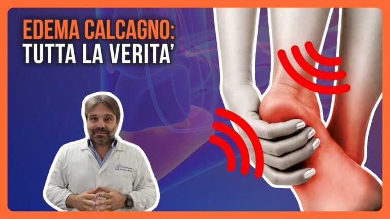 L’Imbibizione Edematosa: Cause e Trattamenti