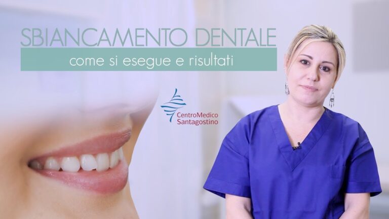 Costo ottimizzato per la pulizia e lo sbiancamento dei denti