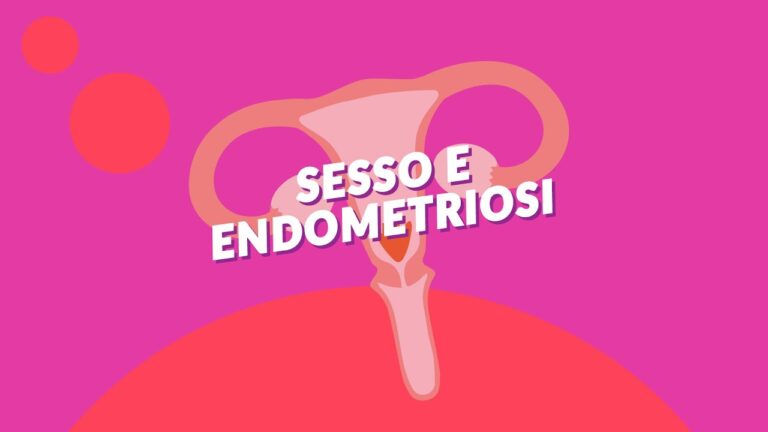 Le migliori posizioni sessuali per chi soffre di endometriosi