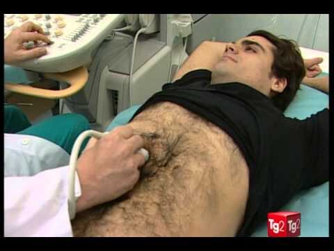 Sintomi del Tumore del Peritoneo: Cosa Sapere