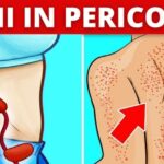Ipoecogeni: il misterioso significato di queste ombre sull’ecografia