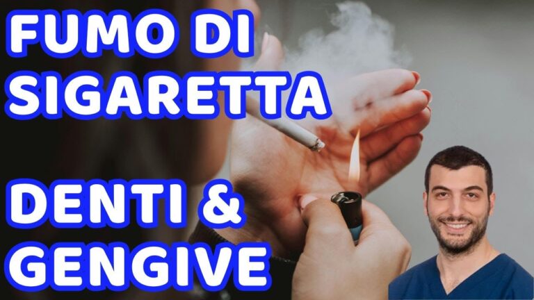 Effetti del fumo sui denti: Denti di un fumatore