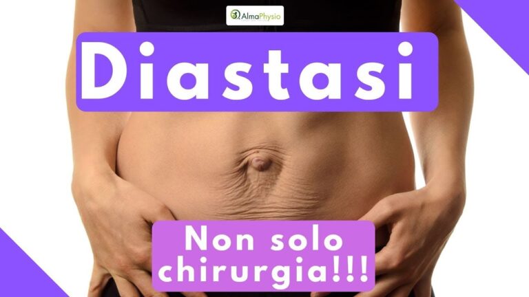 Rimedi efficaci per la diastasi addominale senza intervento