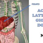 Ruolo dell’anticorpo anti-citrullina nella patologia