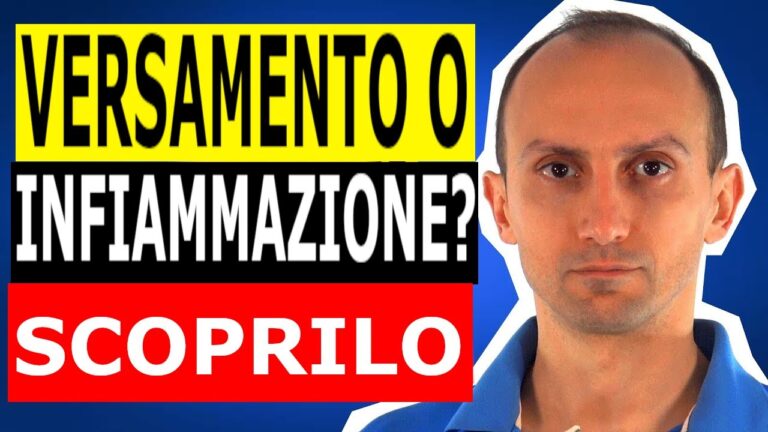 Versamento ginocchio: tempi di recupero ottimizzati