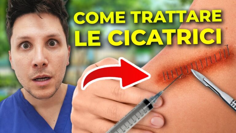 Guida completa al tipo di cicatrici