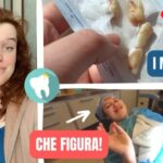 Composizione dei Denti: Cosa Sono Fatti