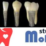 Come sopravvivere a lunghe astinenze dal cibo