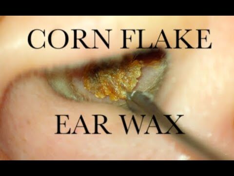 Cornflakes: Il Segreto per una Colazione Sana e Veloce