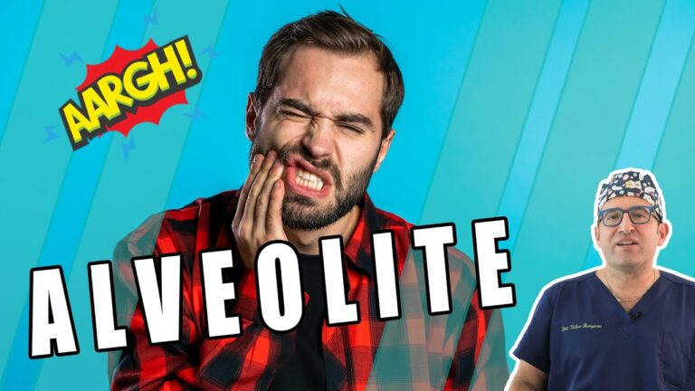 Alveolite Non Guarita: Cause e Soluzioni