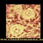 Trasformazione del viso: peeling prima e dopo