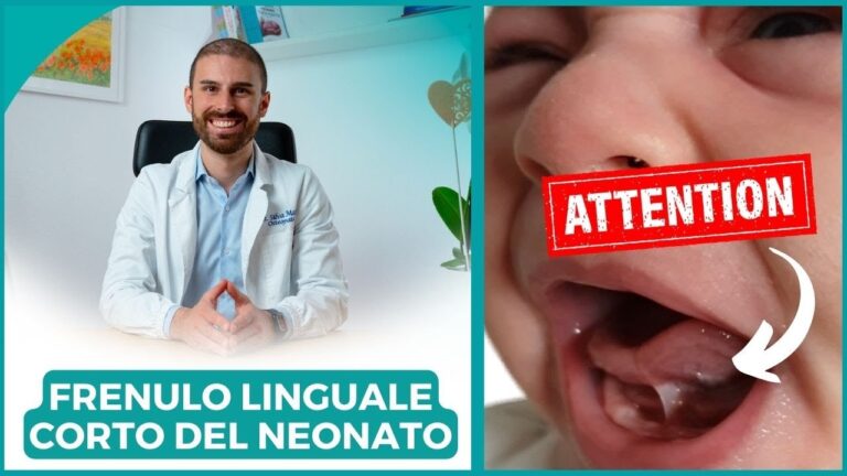 Filo Sotto la Lingua: Cause e Rimedi Efficaci