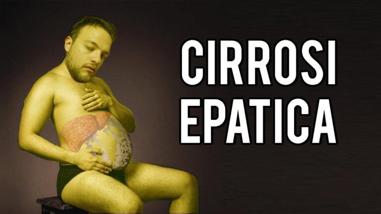 Comprendere la Morte per Cirrosi Epatica: Cause e Prevenzione