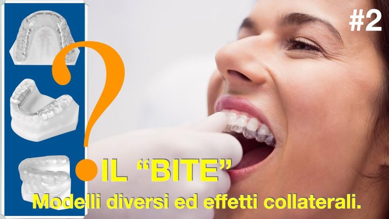 Costo del trattamento dentistico: cosa sapere