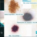 Ottimizzazione dei Costi per le Radiografie Toraciche