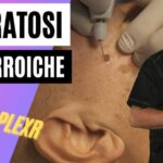 100 addominali al giorno: scopri i sorprendenti risultati in soli 30 giorni!