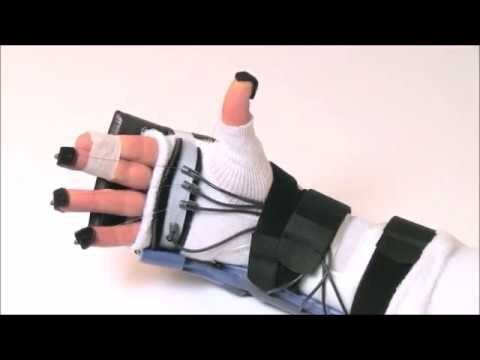 Tempi di Recupero per Lesioni al Tendine della Mano