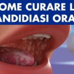 Dopo colica renale: l’importanza del riposo ottimizzato