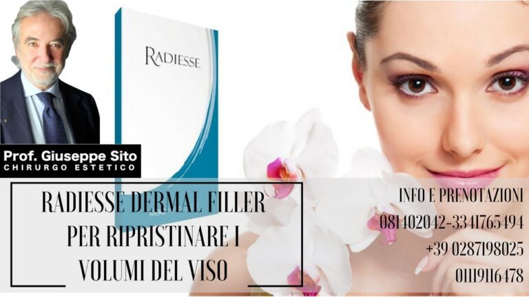 Radiesse: Risultati Prima e Dopo