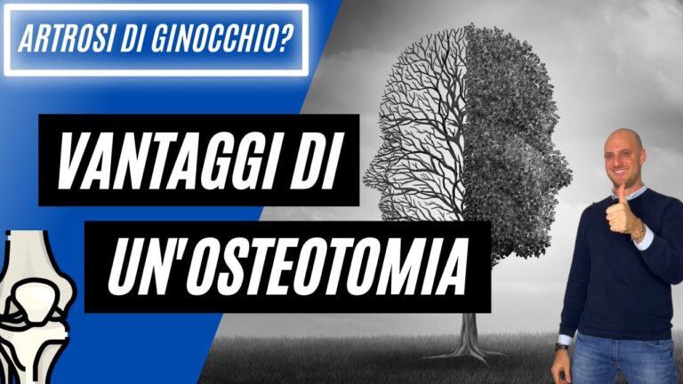 Esperienze di Osteotomia al Ginocchio: Un Percorso di Recupero e Rinnovamento