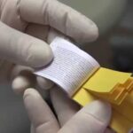 Estrazione dente senza punti: tutto quello che devi sapere