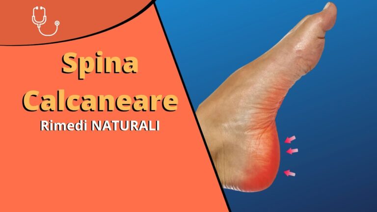 Rimedi Naturali per la Spina Calcaneare