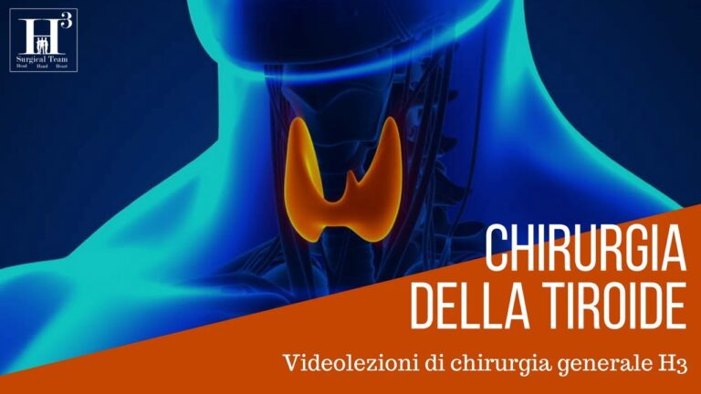 Centri di Eccellenza per la Chirurgia della Tiroide