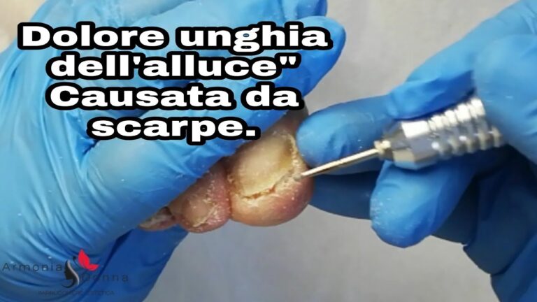 Rimedi per l’Unghia del Piede Dolorante