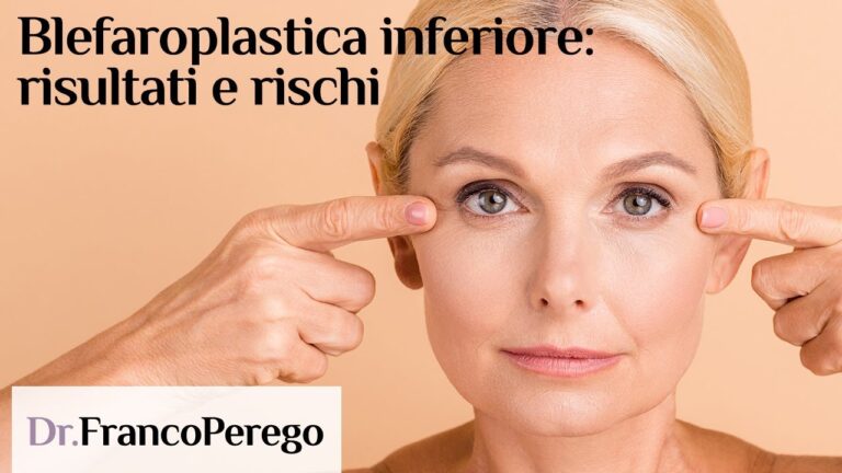 Prezzi della Blefaroplastica Inferiore: Cosa Sapere