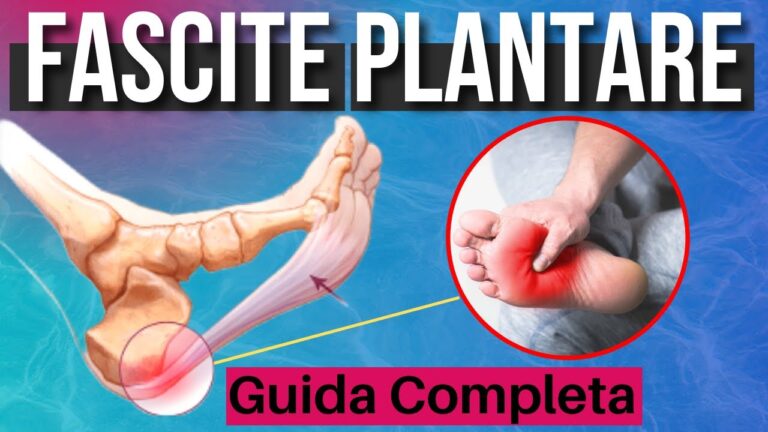 Guarigione dalla Fascite Plantare: Il Mio Percorso di Recupero