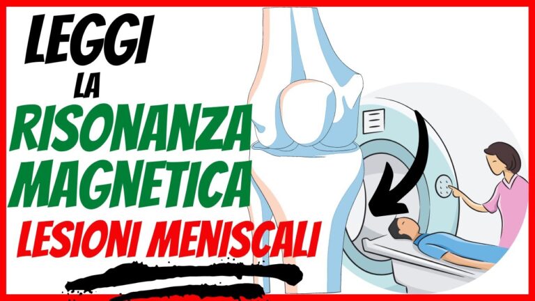 Risonanza Magnetica del Ginocchio: Diagnosi delle Lesioni Meniscali