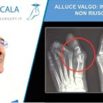 Plaunac 20 mg: Guida ottimizzata all’uso