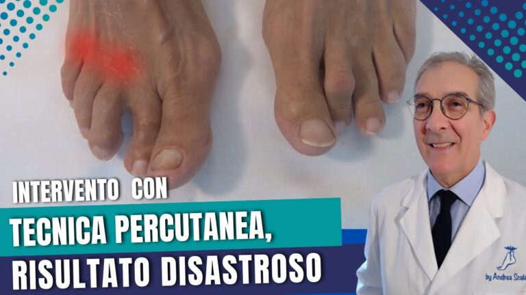 Dito a Martello: Comprendere e Affrontare l’Operazione Dolorosa