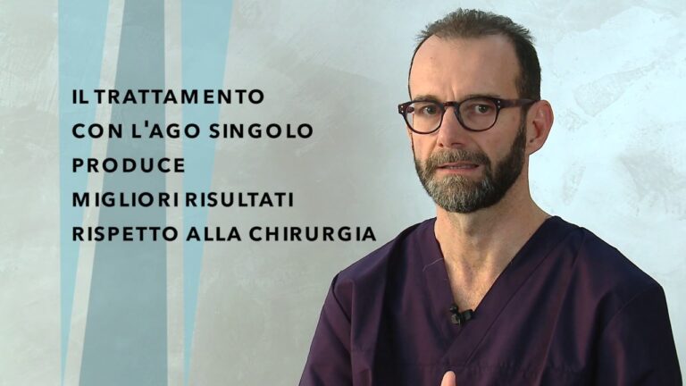 Sintomi della calcificazione alla spalla: cosa sapere