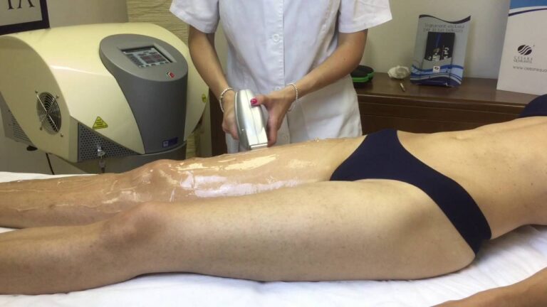 Sedute Laser per Gambe: Quante Ne Servono?