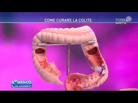 Fermenti Lattici e Colite: Benefici e Soluzioni Naturali