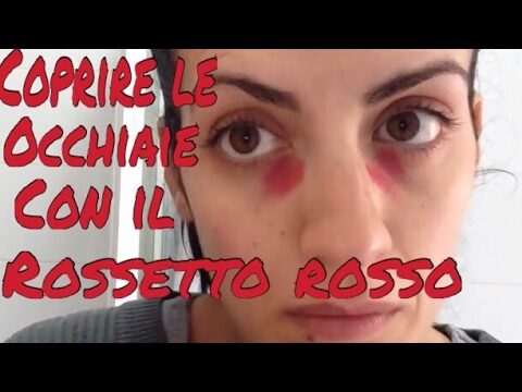 Rimedi Efficaci per le Occhiaie Rosse
