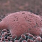 Helicobacter pylori e vitamina D: collegamento e implicazioni