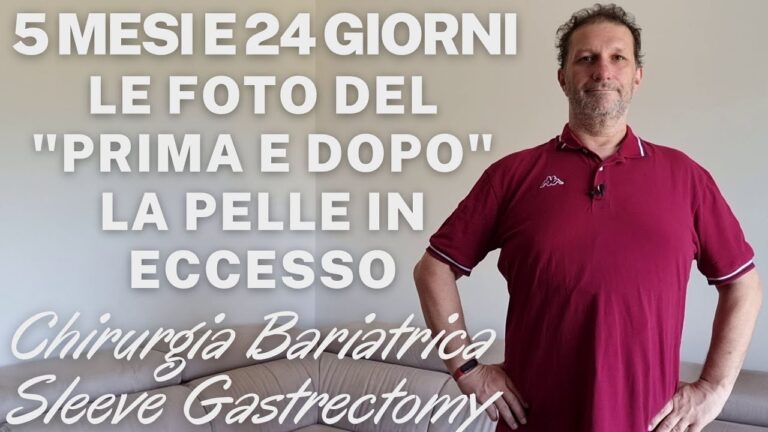 Sleeve Gastrectomy: Risultati Prima e Dopo