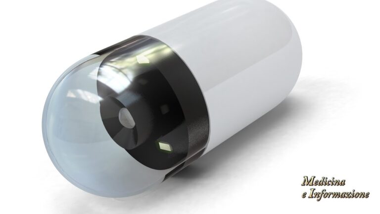 Colonscopia con Videocapsula: Dove Effettuarla?